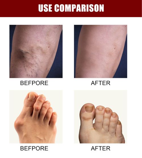 Joint & Bone Therapy Cream,  Intensive Joint & Bone Therapy Cream, Intensive Concentrate for Joint and Muscle Recovery, Provides Relief for Back, Neck, Hands, Feet (White, 30gm Each)