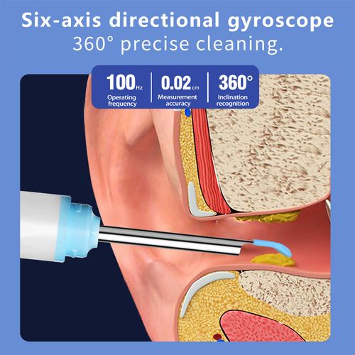 MEKK S5 Smart Ear Wax Removal Kit – 10MP HD Visual Cleaner, Wireless Otoscope, Precision Tweezers, 12 Tools + Travel Case (Works with iOS & Android)