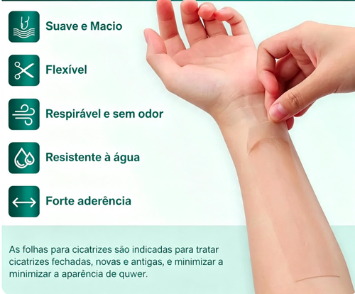 Folhas de silicone premium para cicatrizes, tamanho 1, rolo de 3 metros. Reutilizáveis, eficazes para a remoção de cicatrizes cirúrgicas, queloides, cesarianas e abdominoplastias. Não irritantes, flexíveis, respiráveis e confortáveis no tratamento de cicatrizes.