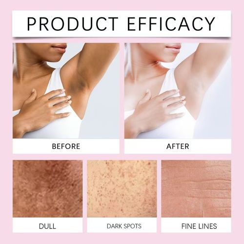 Natural Body Brightening Essence – Contains 10% tartaric acid, niacinamide, and peptide ingredients,It can effectively brighten the skin and keep it moisturized