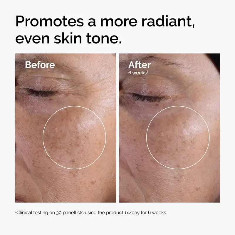 Large-capacity brightening toner.The Ordinary Glycolic Acid 7% Exfoliating Toner, Brightening and Smoothing Daily Toner for More Even-Looking Skin Tone