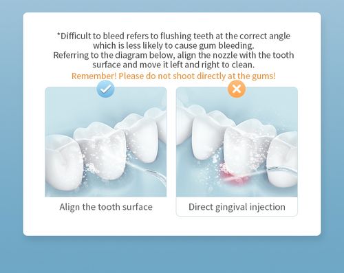 All-New Upgraded Cordless Water Flosser, 300ML Portable Oral Irrigator with 5 Jet Tips, Multi-Modes, Rechargeable IPX7 Waterproof Teeth Cleaner, Oral Plaque Remover, Prevents Bad Breath, Braces Care summeressentials DealsForYouDays
