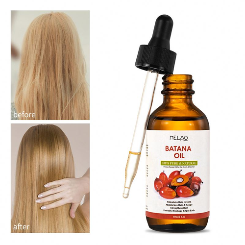 Hair Essential Oil Rosemary Raw Combo for Strengthening Promotes Hair Thickness Honduran Hair Growth Batana Oil