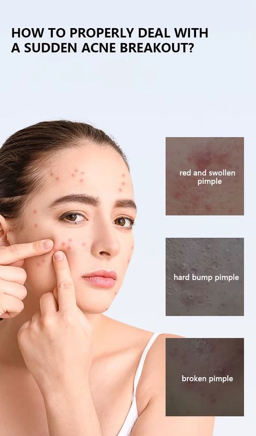 red light pimple patch