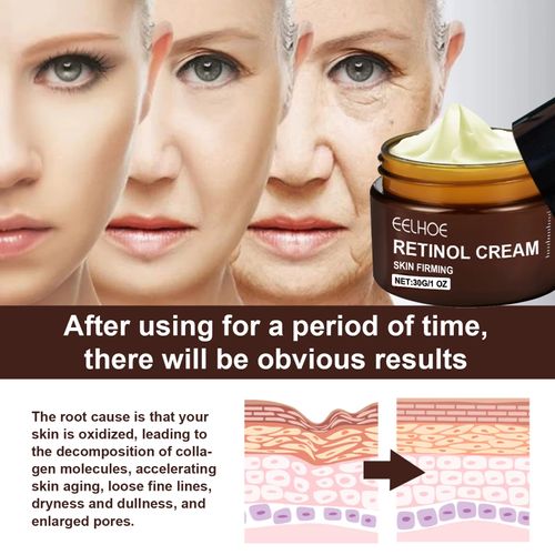 Retinol Anti-Aging Face & Neck Cream