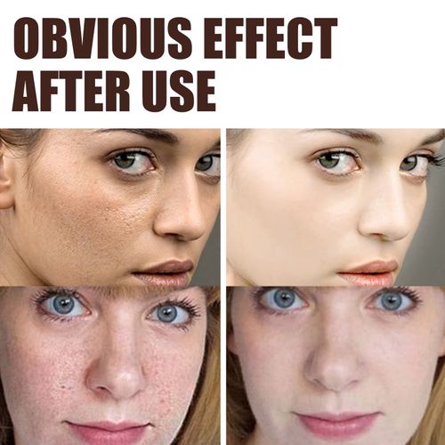 Retinol Anti-Aging Face & Neck Cream