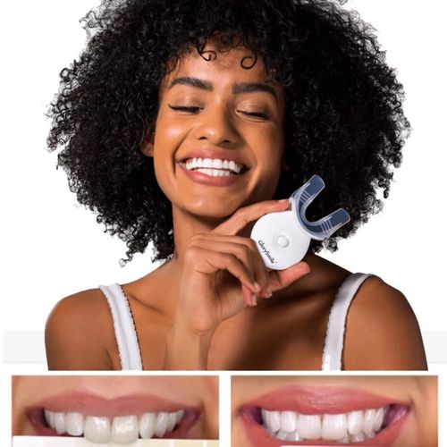 Home Teeth Whitening Kit
