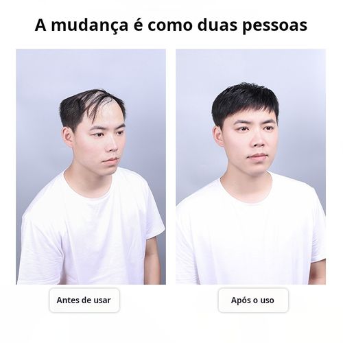 Perucas masculinas, recupere a confiança