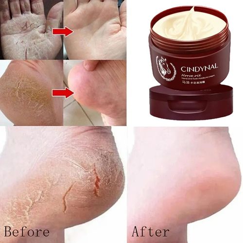 Foot care repair cream for cracked heels