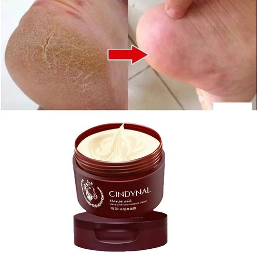 Foot care repair cream for cracked heels