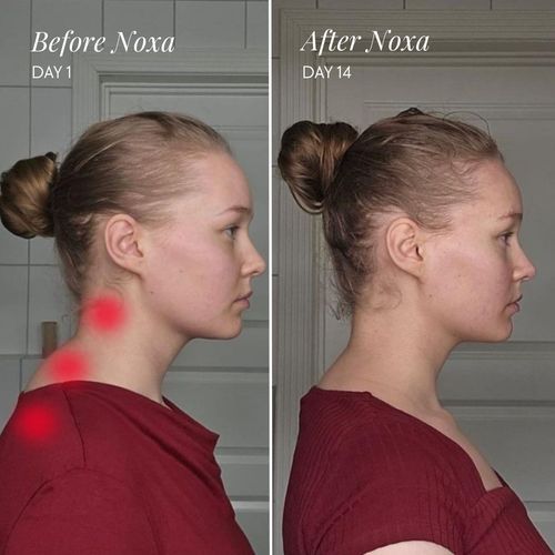 Noxa Neck and Shoulder Massager