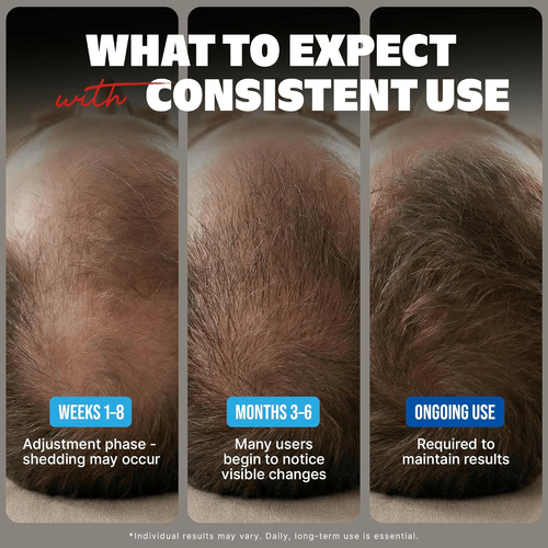 Hair Loss Regrowth Treatment
