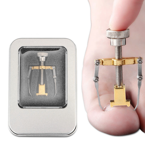 Ingrown Toenail Corrector