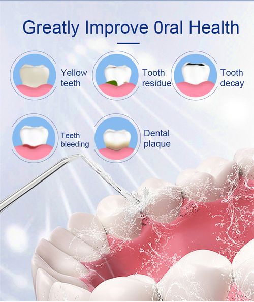Electric Irrigator Oral USB Rechargeable Water Flosser Dental Water Jet 3 Work Models Teeth Cleaner 4 Nozzles