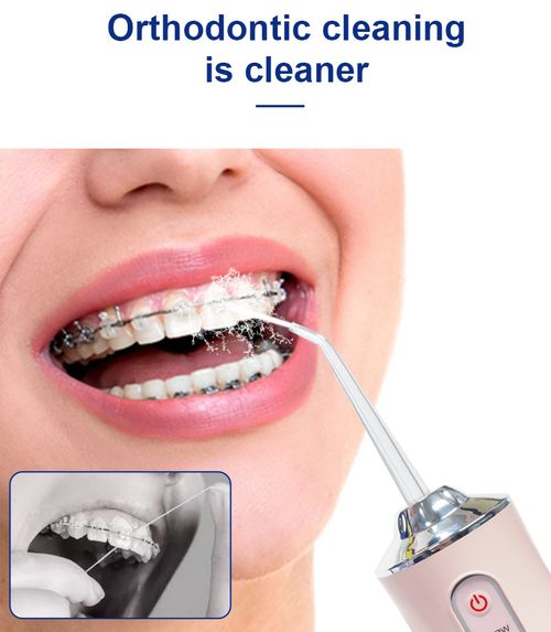Electric Irrigator Oral USB Rechargeable Water Flosser Dental Water Jet 3 Work Models Teeth Cleaner 4 Nozzles