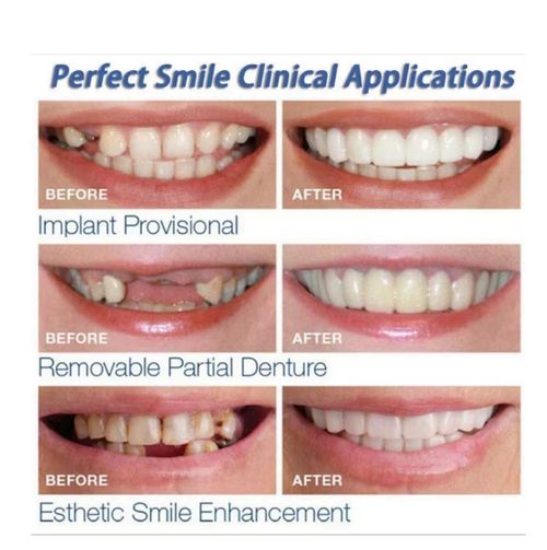 New-style dentures, smile veneers and orthodontic appliances