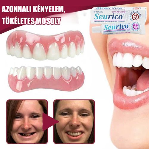 Silicone dental splint + thermoplastic denture adhesive