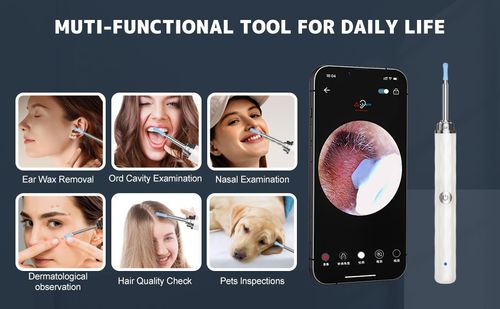 Peek into a world of pristine ears with our HD Ear Cleaner Camera