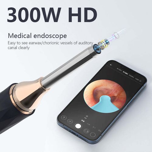 Peek into a world of pristine ears with our HD Ear Cleaner Camera
