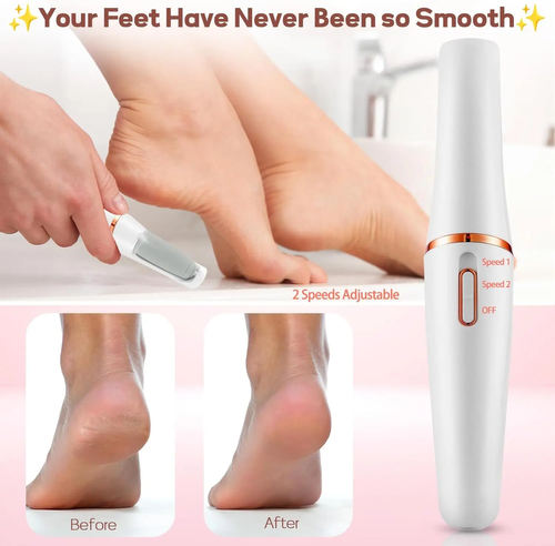 New rechargeable electric callus remover wireless men and women electronic foot dermabrasion device to remove dry rough heel calluses 2025