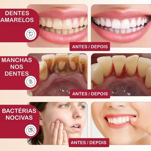 SP-4: Pasta Clareadora com Proteção Total