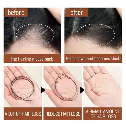 Unrefined Batana Oil Hair Conditioner 100g - Hydrating Keratin Treatment Moisturizer for Normal Hair with Natural Ingredients Including Biotin, Jojoba Oil, Palm Oil - Nourishing & Smoothing Hair Mask