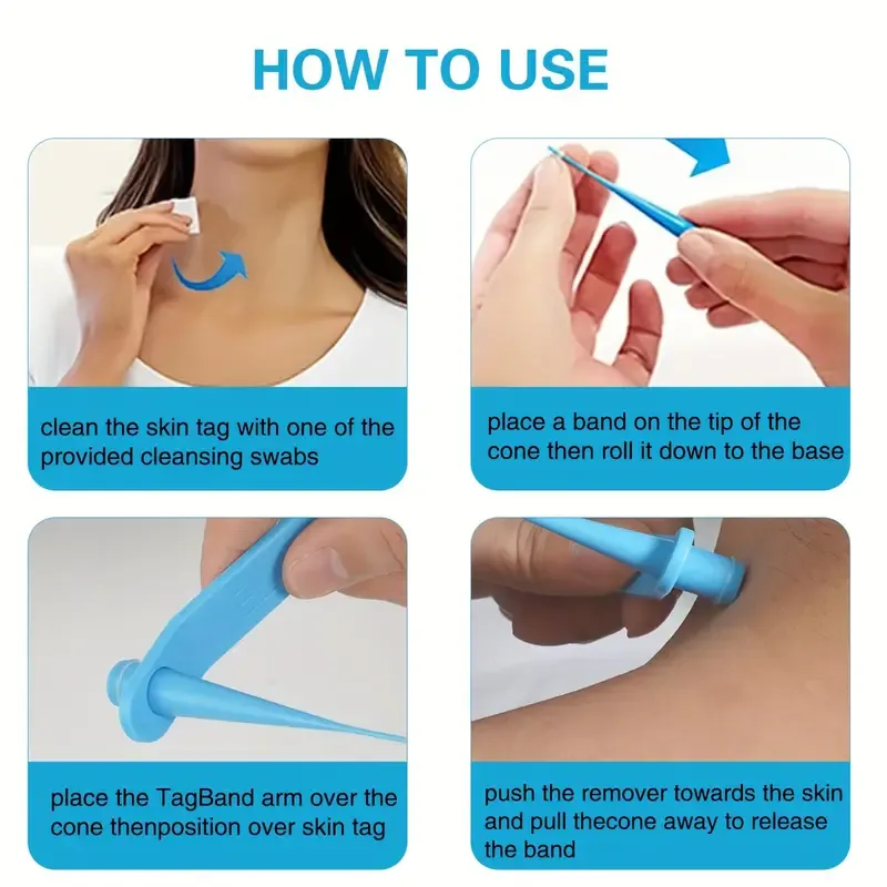 Removal Mole Kit Tools