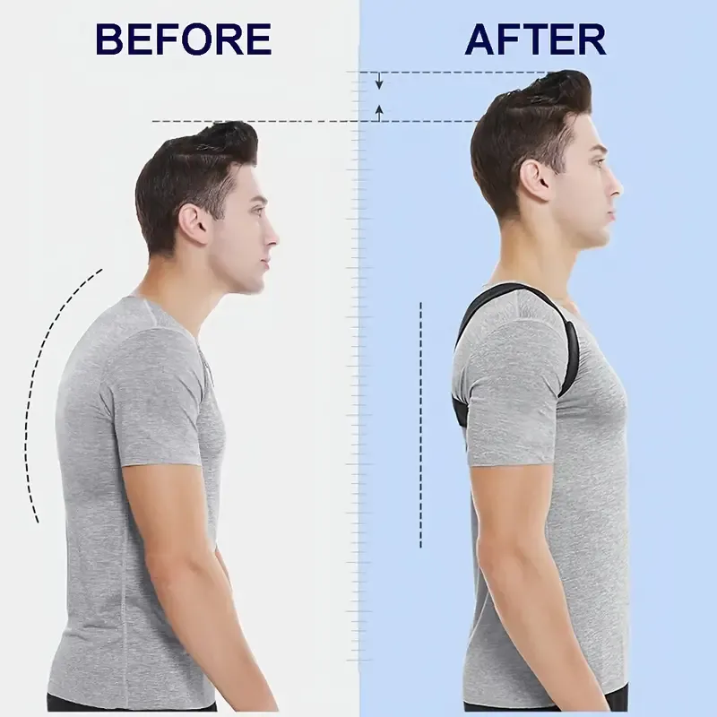 Posture Back Brace For Men And Women, Breathable Material And Durable Buckle - Adjustable Back Support With Stylish Patterns