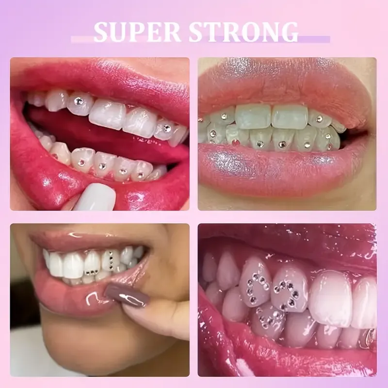 DIY Tooth Gem Kit