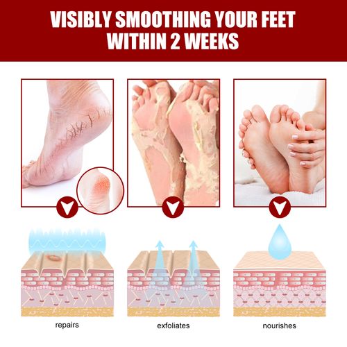 Exfoliating Foot Mask Set