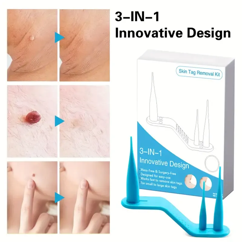 Removal Mole Kit Tools