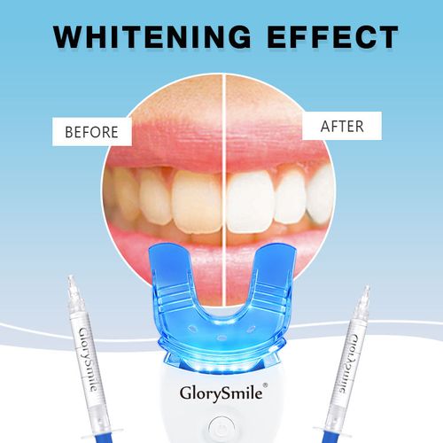 Teeth Whitening Device