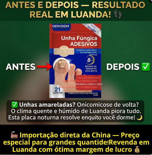 (Fungal Nail) Sem preocupação em Luanda! Coloque uma placa à noite e unhas onicomicóticas desaparecem silenciosamente 💨