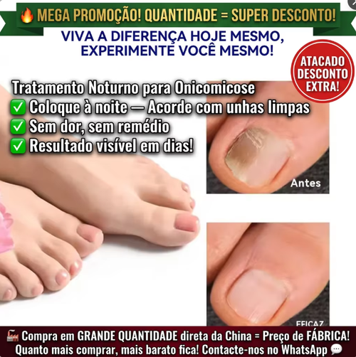 (Fungal Nail) Sem preocupação em Luanda! Coloque uma placa à noite e unhas onicomicóticas desaparecem silenciosamente 💨