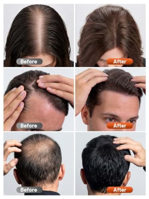RELEXNOW Red Light Therapy Cap for Hair with Upgraded 180 Tri-Chip LEDs