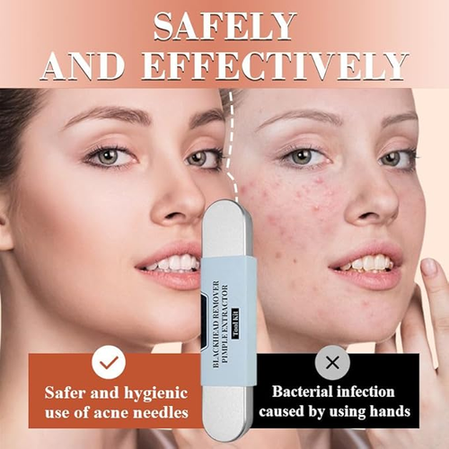 Cell clamp blackhead clamp acne needle set