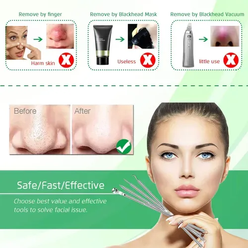 Stainless steel blackhead removal kit Hot sale, low discount on the whole network!