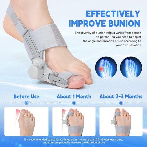 Complete set of big toe corrector for relieving big toe cysts