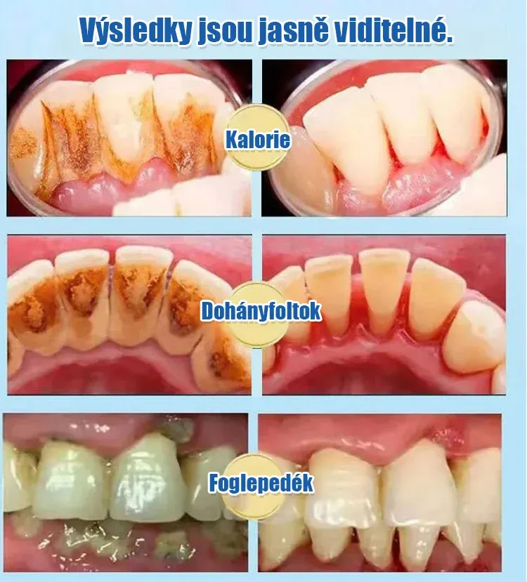 Get brighter teeth in 7 days Probiotic Whitening Toothpaste