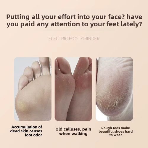 3 In 1 Electric Foot Grinder Foot Care Device Rechargeable Pedicure Machine Removes Dry Skin For Smoother Feet Pedicure Tools