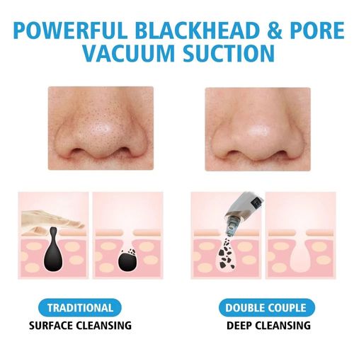 Blackhead pore vacuum cleaner