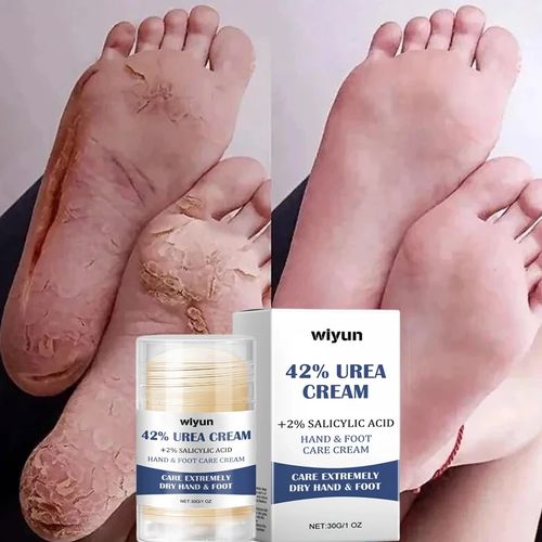 3PCS Beauty Product Herbal Anti Crack Foot Cream Heel Cracking Repair Products Exfoliation Dead Skin Removal Softening Moisturize