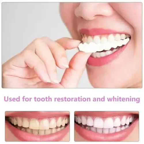 Adult Adjustable Dentures Teeth Set Adjustable Snap-on Fake Teeth Portable Braces Decorate Gaps For Teeth Enhance Aesthetic