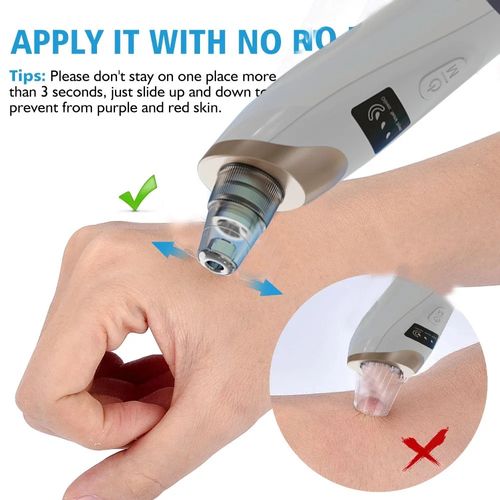 Blackhead pore vacuum cleaner