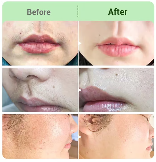 Hair Removal Cream Kit