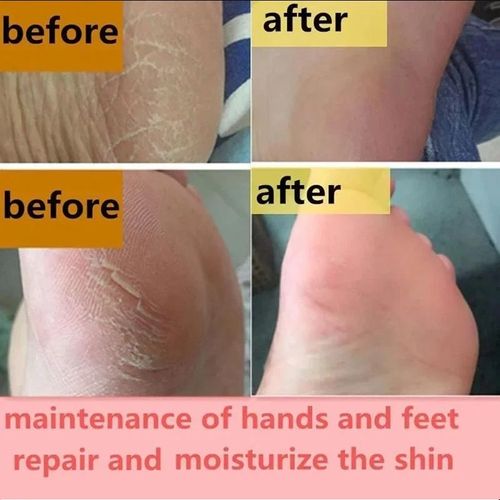 3PCS Beauty Product Herbal Anti Crack Foot Cream Heel Cracking Repair Products Exfoliation Dead Skin Removal Softening Moisturize