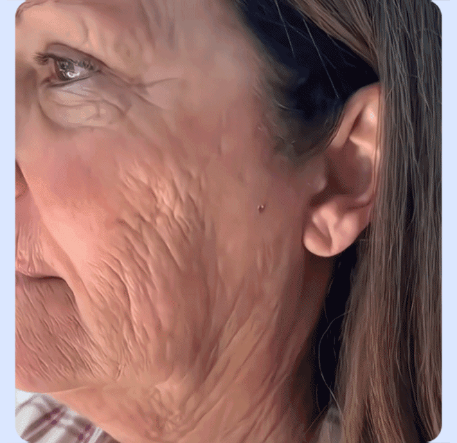 2 pcs Smoothing cream with peptides in an anti-wrinkle injection tube