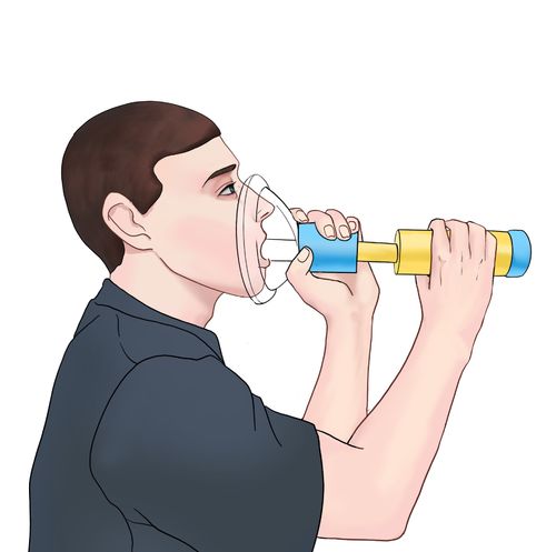 Choking Emergency Device
