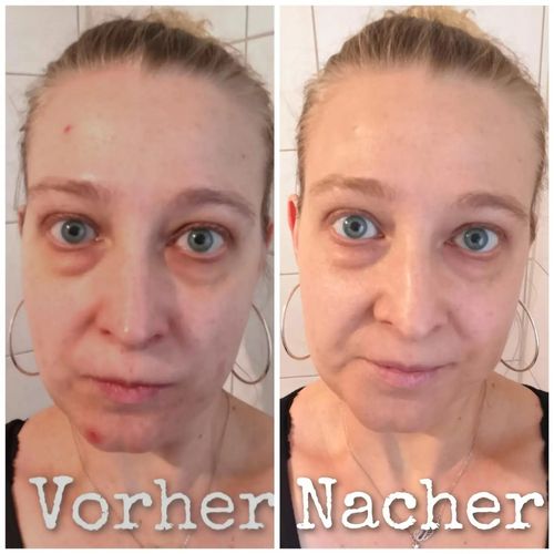 Five-in-one Vitamin C tinted moisturizer: Conceals imperfections, provides sun protection, brightens skin tone, and acts as a makeup base for a natural, non-cakey look.