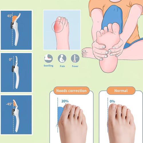 Orthopedic Bunion Corrector Suitable for Women & Men